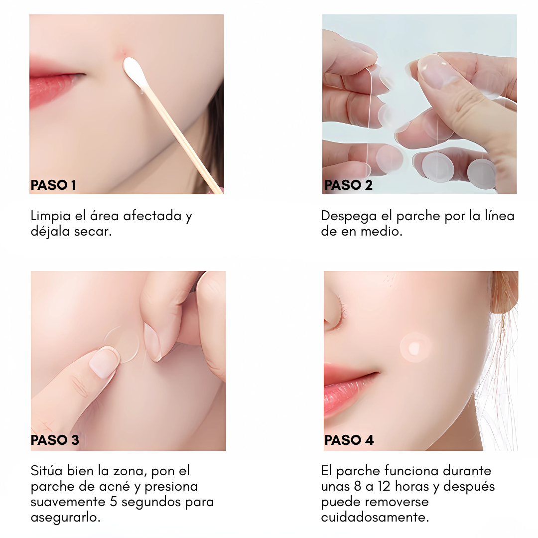 PARCHES INVISIBLES PARA EL ACNÉ IMPERMEABLES (72 Unds.) – Discreción y cuidado en cada aplicación