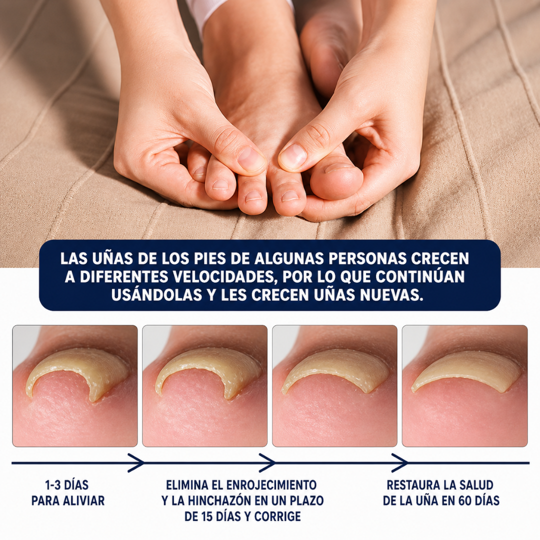 ACEITE PARA UÑA ENCARNADA (2 UNIDADES) — Alivia el dolor, ablanda el tejido y corrige la uña desde la raíz sin cirugía