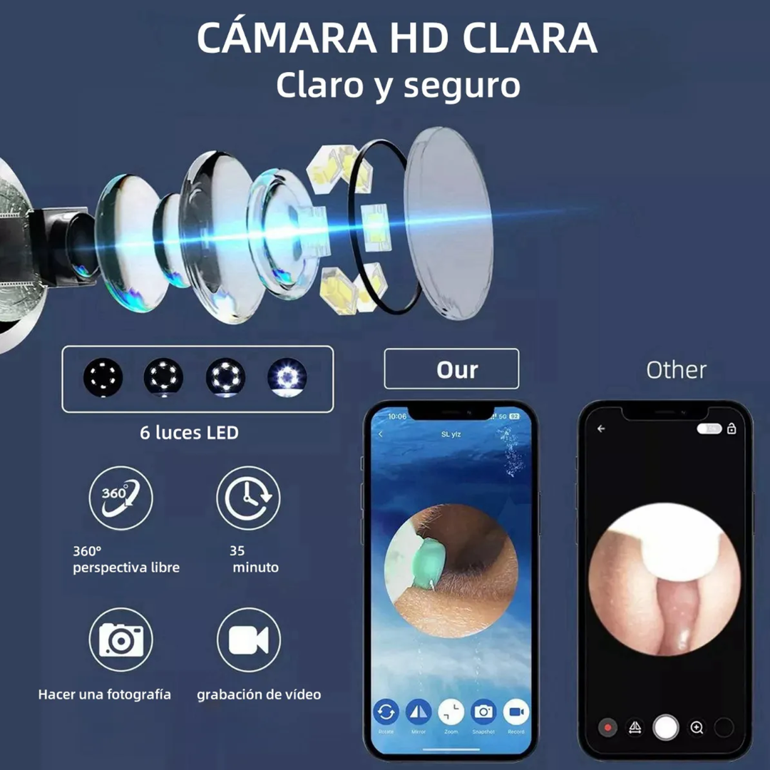 REMOVEDOR DE CERUMEN CON CÁMARA — Ve lo que hay dentro y límpialo de verdad, sin cotonetes y sin riesgo