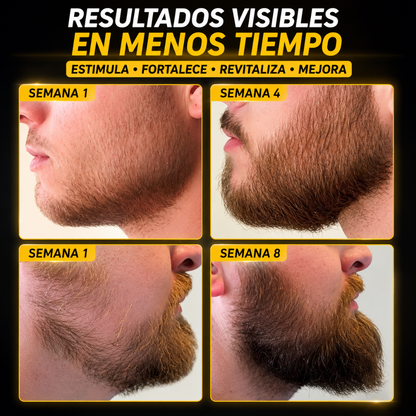 DERMA ROLLER PROFESIONAL – Barba y entradas más cuidadas