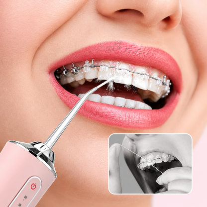 IRRIGADOR BUCAL — Llega donde el cepillo nunca llega y deja la boca con una limpieza que el hilo dental no da