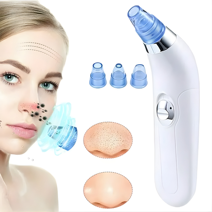 EXTRACTOR DE PUNTOS NEGROS – Limpieza profunda de poros, piel más suave y cuidado facial desde casa