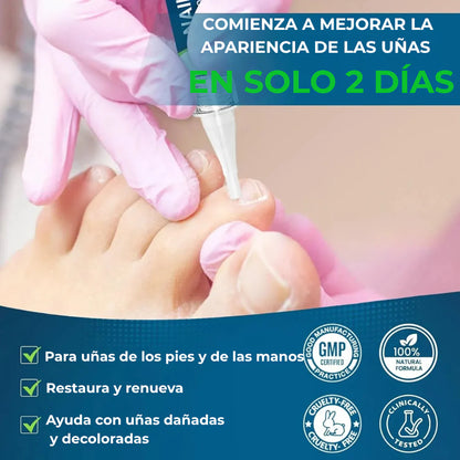 LAPIZ HONGOS – Tratamiento localizado, acción antifúngica y recuperación visible en uñas y piel