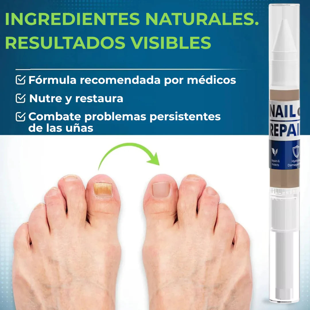 LAPIZ HONGOS – Tratamiento localizado, acción antifúngica y recuperación visible en uñas y piel