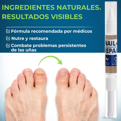 LAPIZ HONGOS – Tratamiento localizado, acción antifúngica y recuperación visible en uñas y piel