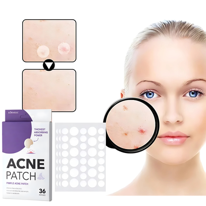 PARCHE PARA EL ACNÉ – Discreción y cuidado en cada aplicación