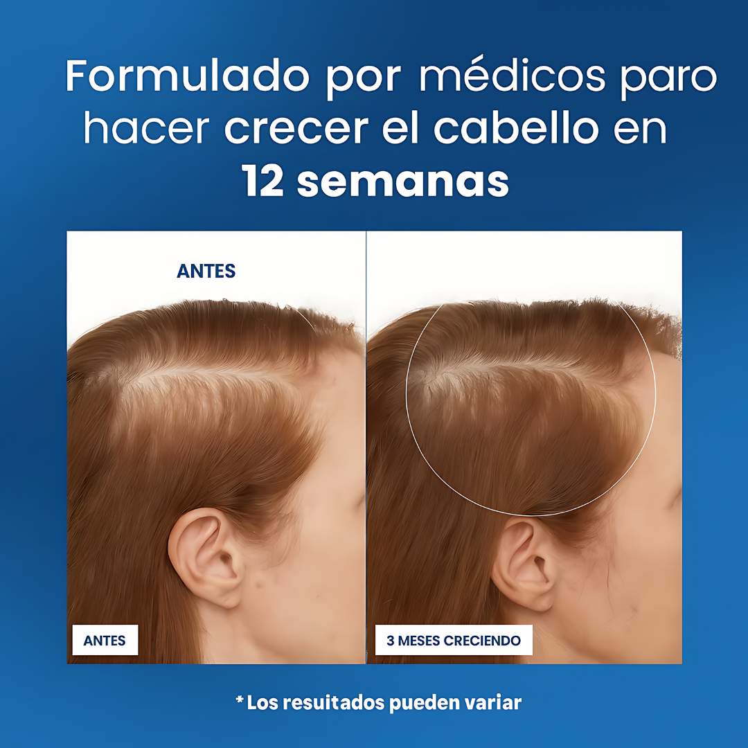 BODYWISE-50 ML — Apoyo para entradas, barba y densidad capilar masculina