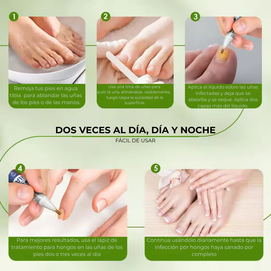 LAPIZ HONGOS – Tratamiento localizado, acción antifúngica y recuperación visible en uñas y piel