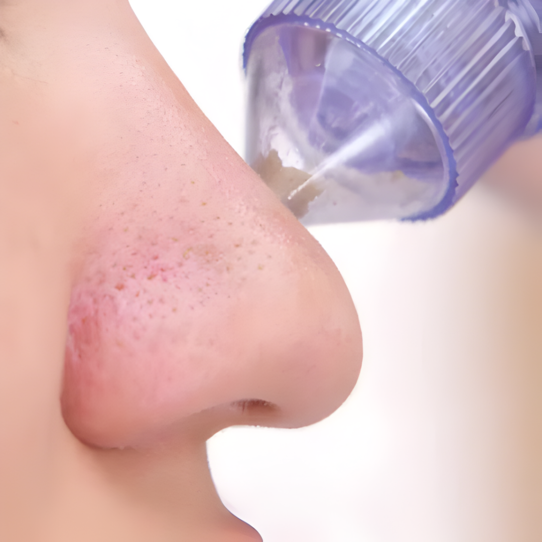 EXTRACTOR DE PUNTOS NEGROS – Limpieza profunda de poros, piel más suave y cuidado facial desde casa