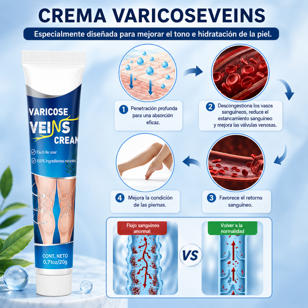 CREMA PARA ALIVIAR LAS VARICES – Alivio para piernas cansadas