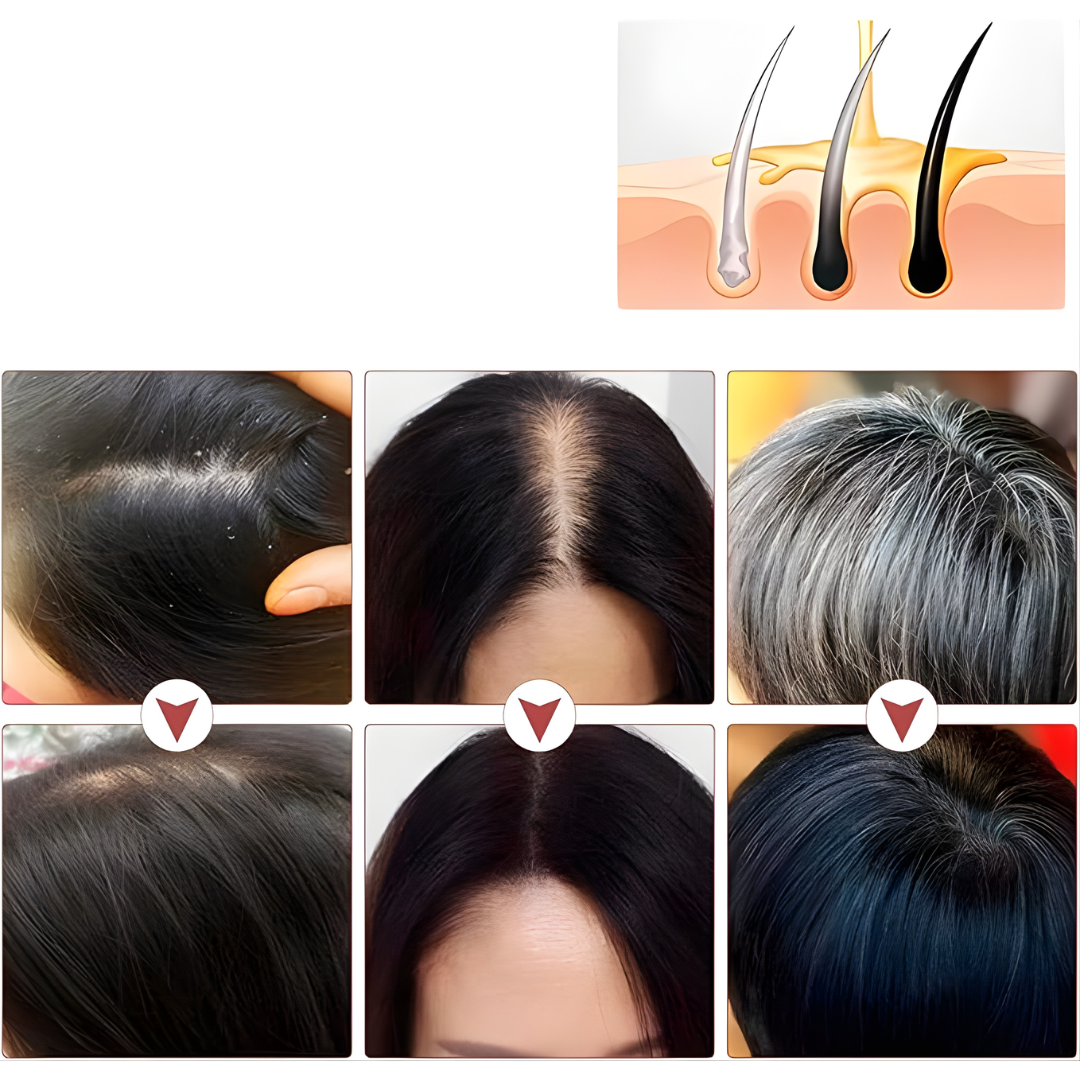 JABÓN SHAMPOO PARA EL CRECIMIENTO DEL CABELLO – Limpieza profunda, fortalecimiento capilar y cuidado del cuero cabelludo