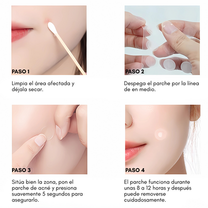 PARCHES INVISIBLES PARA EL ACNÉ IMPERMEABLES (72 Unds.) – Discreción y cuidado en cada aplicación