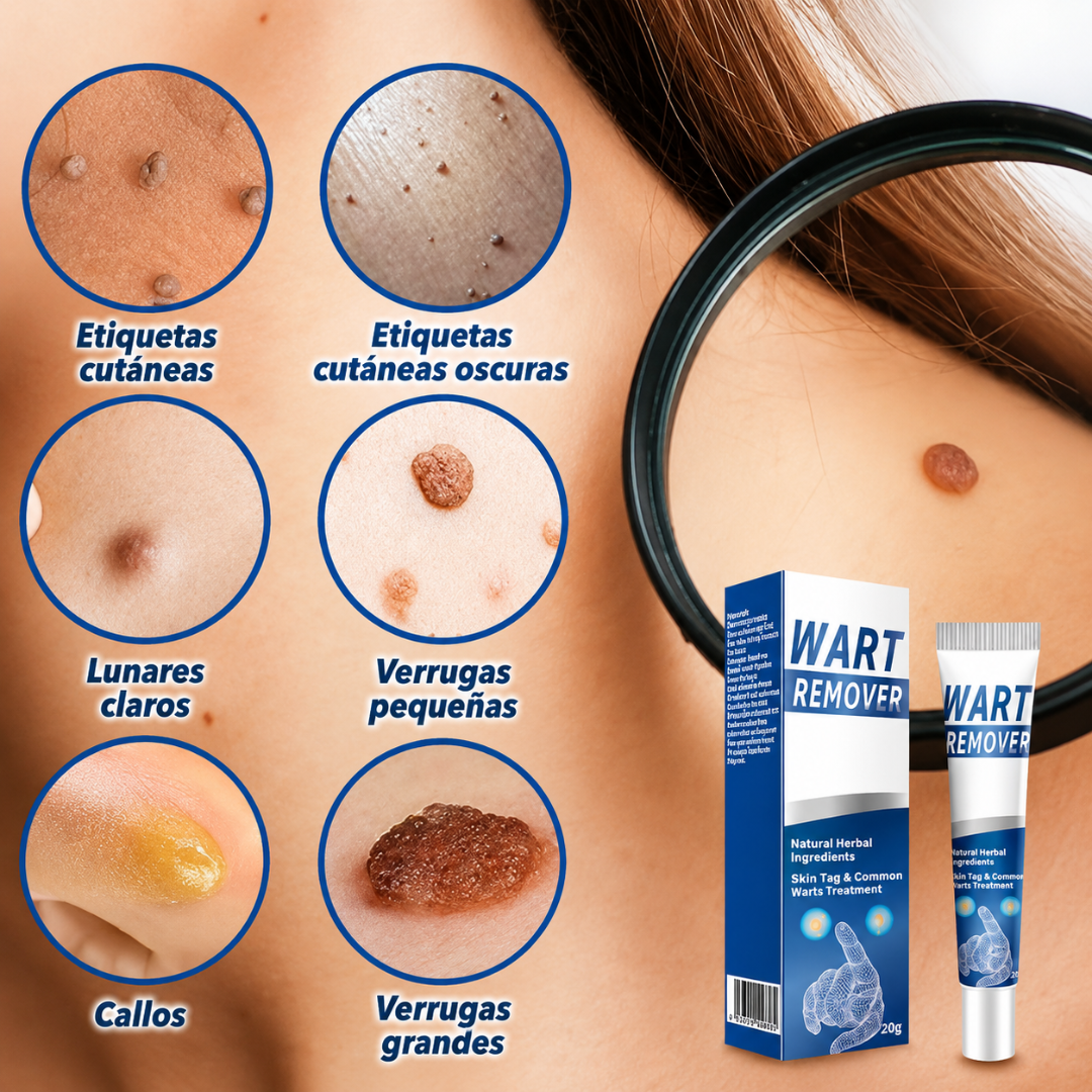 CREMA PARA ELIMINAR VERRUGAS – Cuidado localizado para imperfecciones