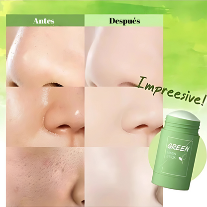 GREEN MASK LIMPIADOR DE IMPUREZAS – Purifica tu piel desde la primera aplicación