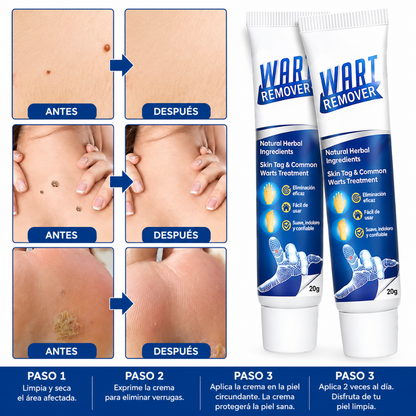 CREMA PARA ELIMINAR VERRUGAS – Cuidado localizado para imperfecciones