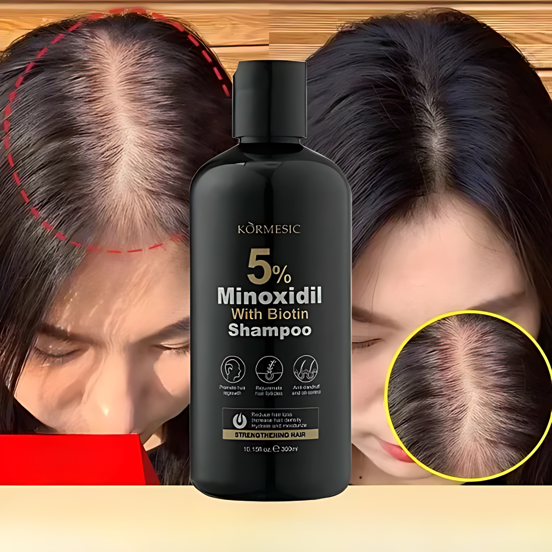 BIOTIN SHAMPOO MINOXIDIL 5% – Frena la caída y estimula el crecimiento desde la raíz