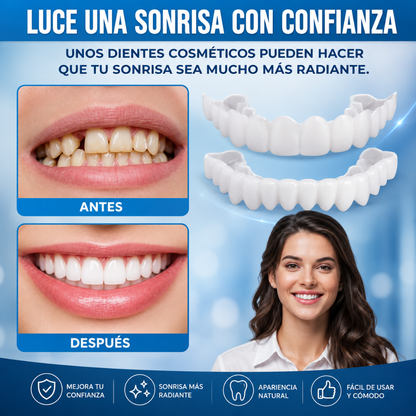 CARILLAS DENTALES SNAPON SMILE – Sonrisa renovada al instante