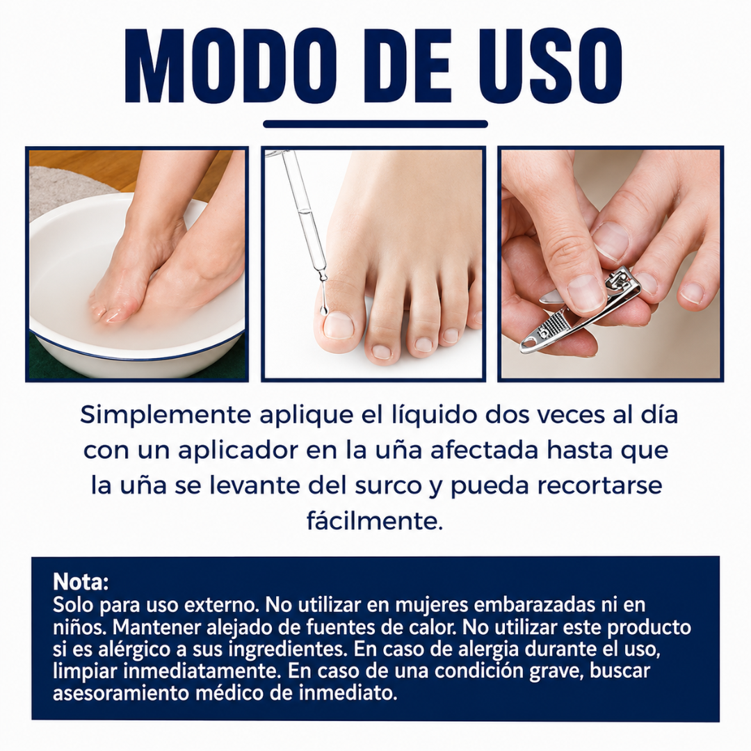ACEITE PARA UÑA ENCARNADA (2 UNIDADES) — Alivia el dolor, ablanda el tejido y corrige la uña desde la raíz sin cirugía