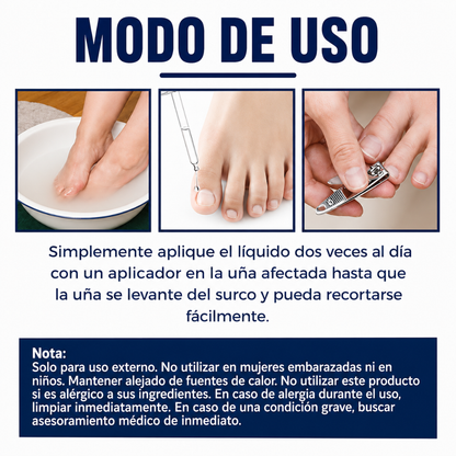 ACEITE PARA UÑA ENCARNADA (2 UNIDADES) — Alivia el dolor, ablanda el tejido y corrige la uña desde la raíz sin cirugía
