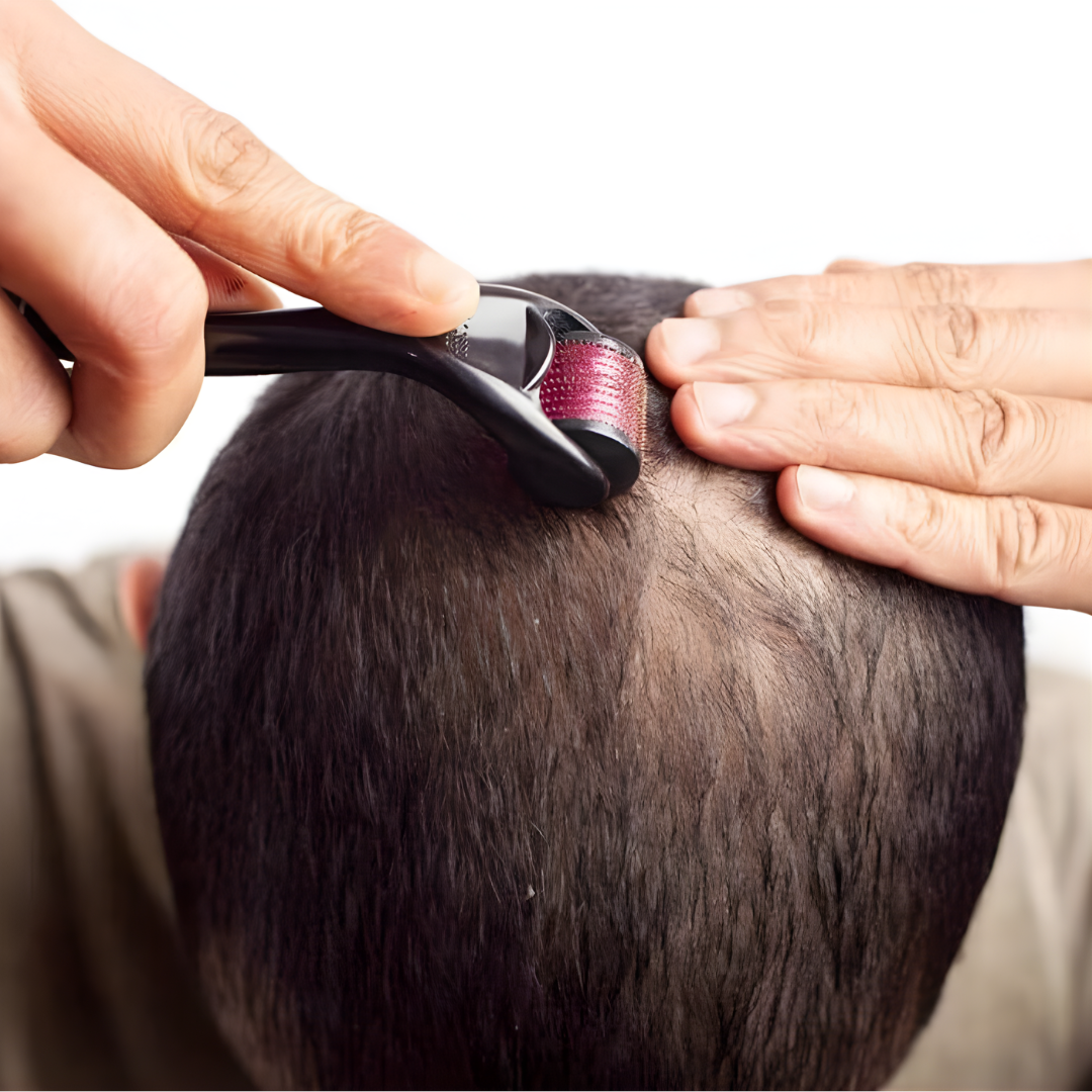 DERMAROLLER RODILLO PARA LA PIEL, BARBA Y CABELLO – Renovación facial desde casa