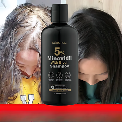 BIOTIN SHAMPOO MINOXIDIL 5% – Frena la caída y estimula el crecimiento desde la raíz