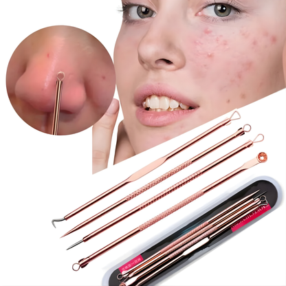 KIT ANTIACNÉ – Elimina granos y puntos negros con precisión