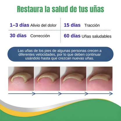 CURA PARA LOS HONGOS – Corrige, protege y recupera la forma natural de tus uñas