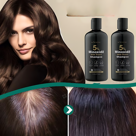 BIOTIN SHAMPOO MINOXIDIL 5% – Frena la caída y estimula el crecimiento desde la raíz