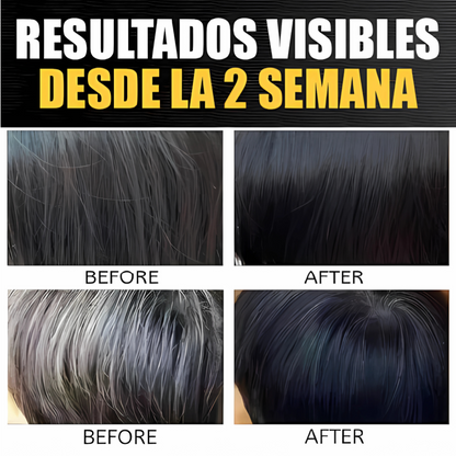 BLACK SOAP CUBRE CANAS – Jabón anticanas natural