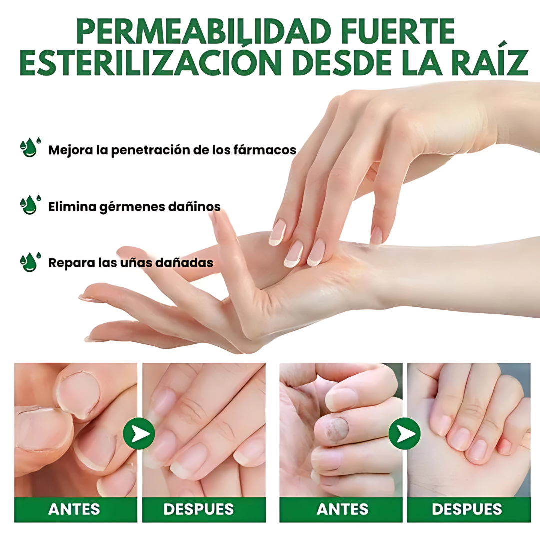 FNH – Limpia y recupera la salud de tus uñas