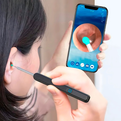 REMOVEDOR DE CERUMEN CON CÁMARA — Ve lo que hay dentro y límpialo de verdad, sin cotonetes y sin riesgo