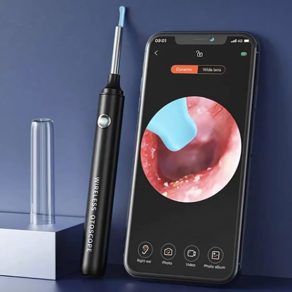 REMOVEDOR DE CERUMEN CON CÁMARA — Ve lo que hay dentro y límpialo de verdad, sin cotonetes y sin riesgo