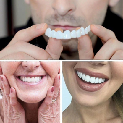 Dientes postizos PerfectDent – Corrige, protege y brilla.